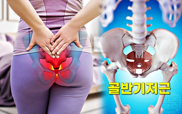 요실금 치료 운동 골반기저근 운동