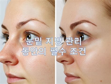 눈밑레이저