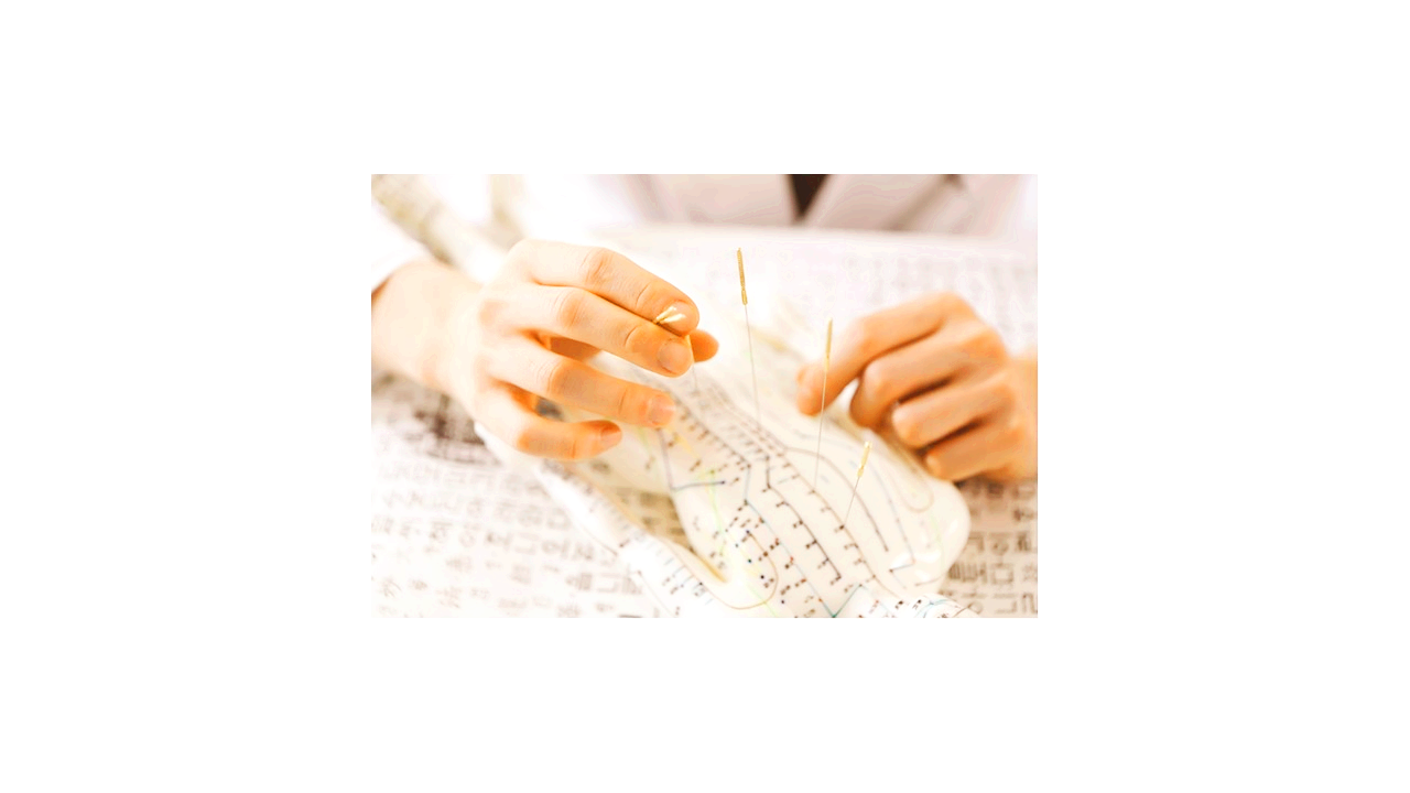 환자에게 여러 개의 침을 놓고 있는 한의사