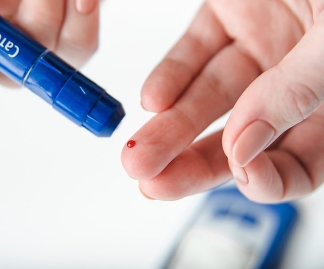 간헐적 단식 방법