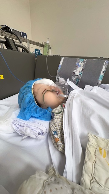 산소호흡기 쓰고 있는 아기