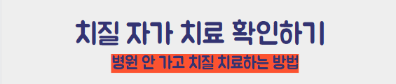 치질 자가치료법 알아보기