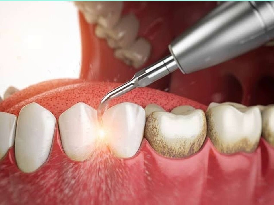 스케일링하는 장면 CG