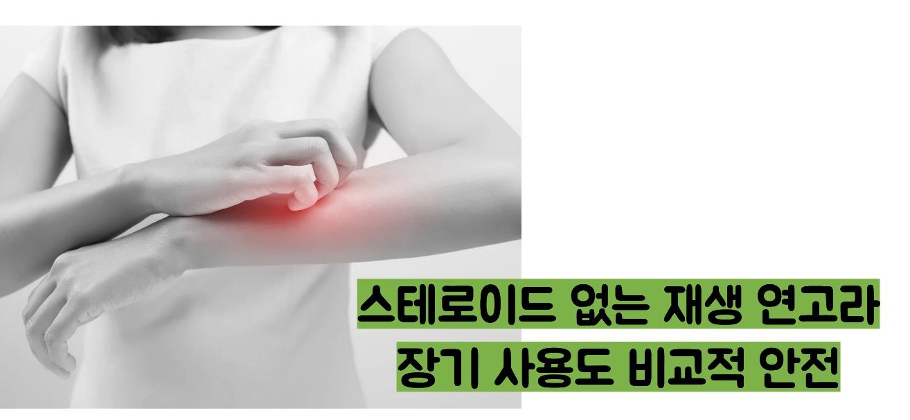 비판텐 연고 효능
