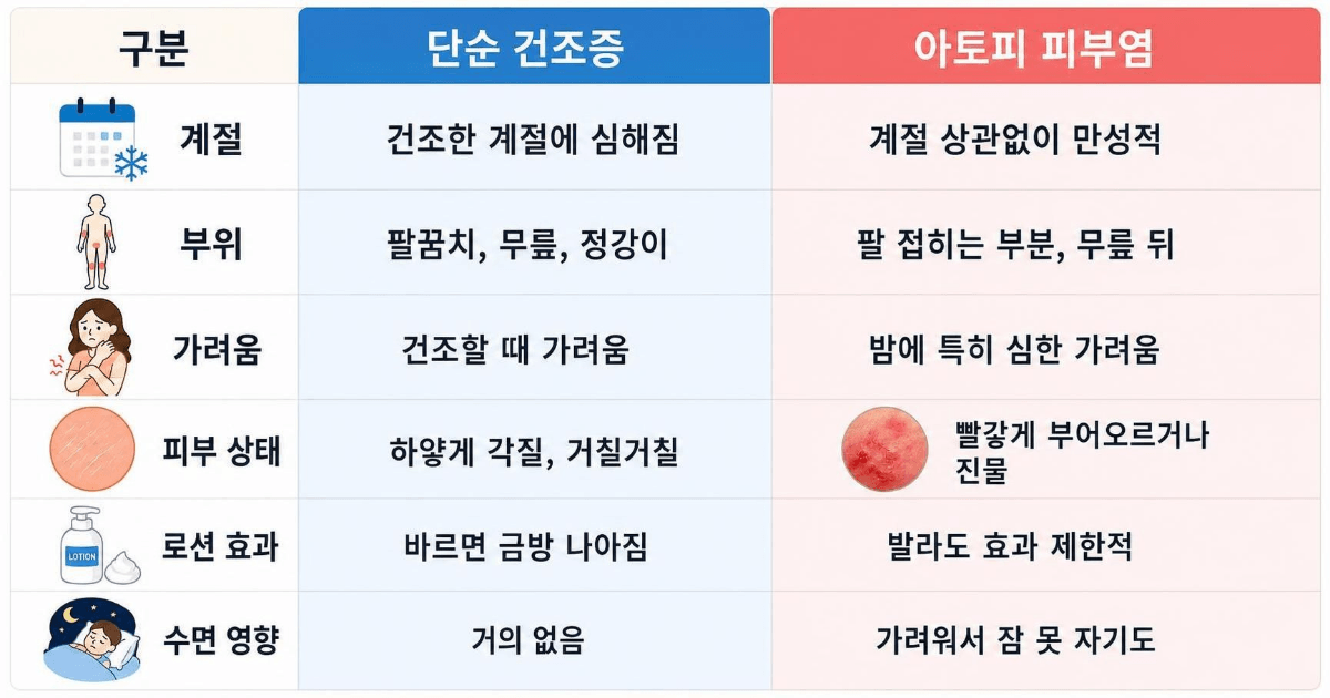 피부 건조증,아토피 구분하는 방법