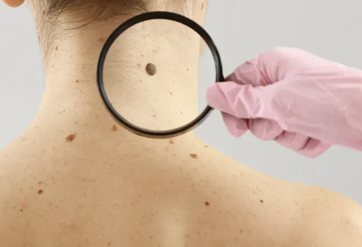 없던 점이 생기는 이유