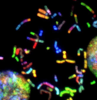 아토피 피부염 증상 근본 원인 치료 방법