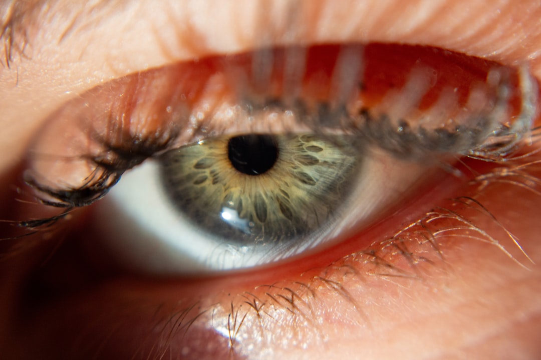 Eye health.