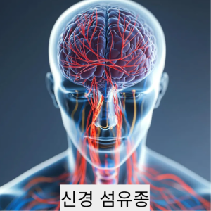 신경 섬유종