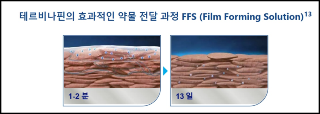 라미실 원스 효과