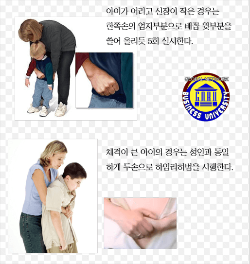 어린이 하임리히법 사진 설명
