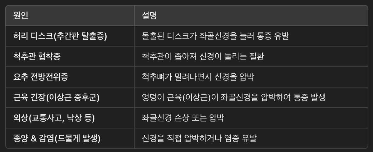 좌골신경통의 원인