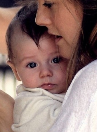 아기 후두염 &amp;#39;크룹 &amp;#39; 원인 증상 /급성 후두염 크룹