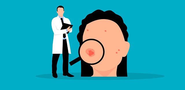 얼굴에 트러블이 난 일러스트