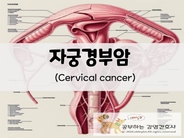 자궁경부암(cervical cancer): 원인 및 증상, 필수 검사와 비용