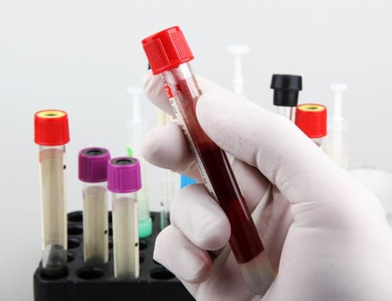 간 기능 검사(LFT, Liver Function Test): 건강한 간을 위한 필수 검사