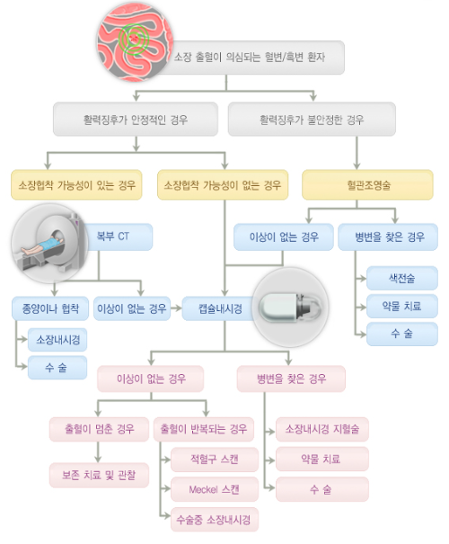 소장 출혈의 진단과 치료