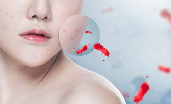 얼굴이 가려운 이유