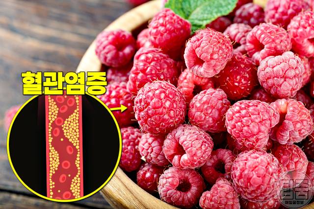 혈관에 좋은 과일 혈행개선제 음식 추천 라즈베리