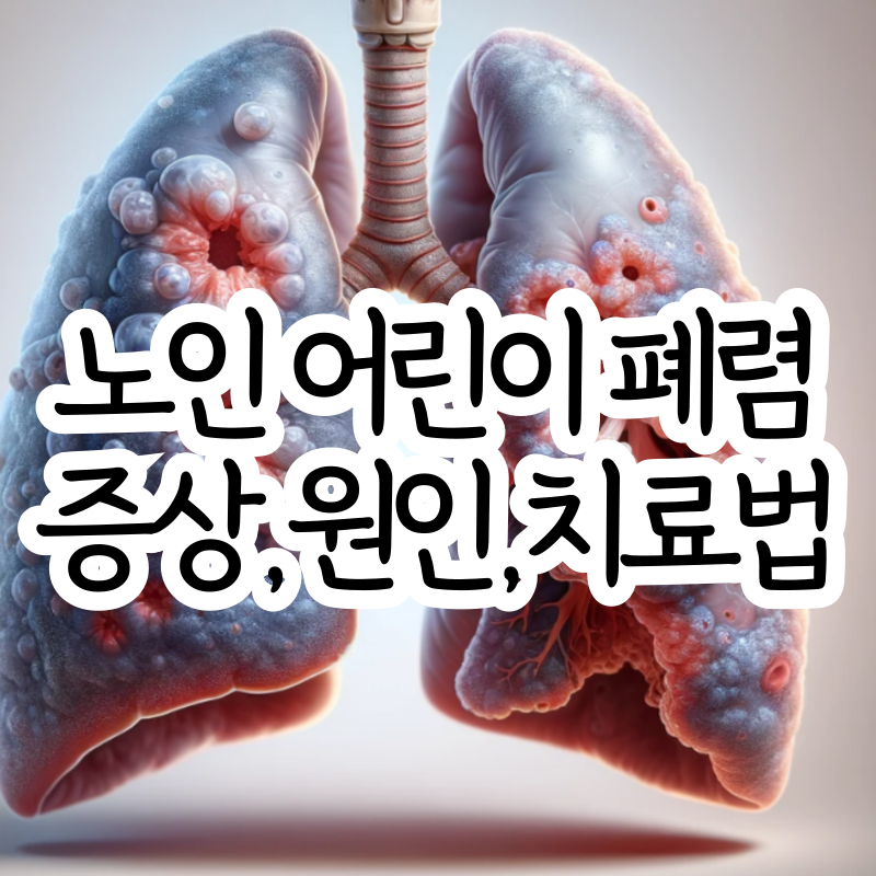 노인 어린이 폐렴 초기 증상 원인 치료 방법