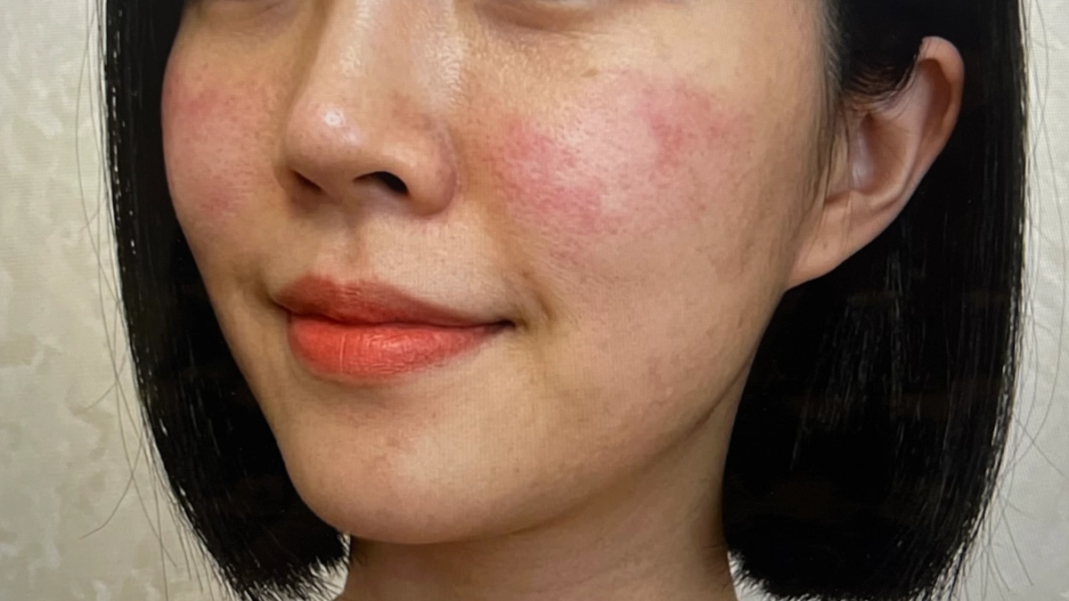 식스킨 볼케이노샷 후기 내돈내산 증명사진