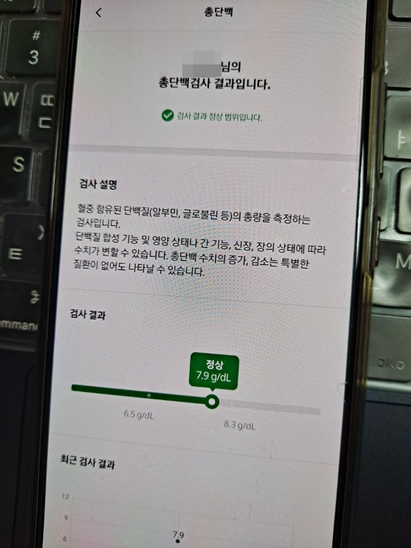 총 단백질 수치