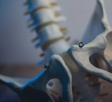 비타민D 부족 증상 섭취방법 많은 음식