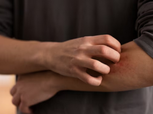 피부 가려움증의 원인