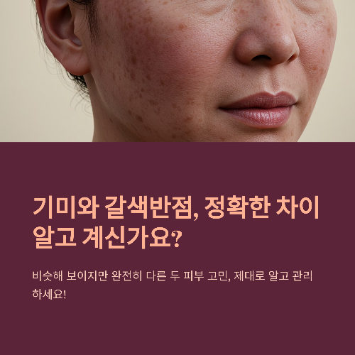 기미와 갈색반점, 똑같은 걸까? 피부 고민 제대로 파헤치기