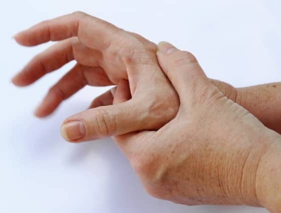 손 마비 이미지