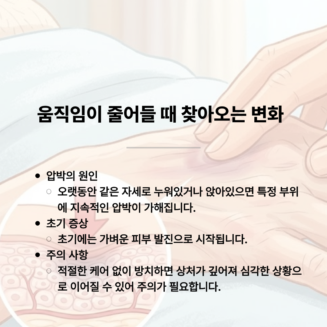 오랜 침상 생활과 움직임 감소로 인해 특정 부위에 가해지는 압박의 원인과 초기 발진 증상, 주의 사항에 대해 설명하는 돋움병원의 욕창 예방 안내 일러스트.