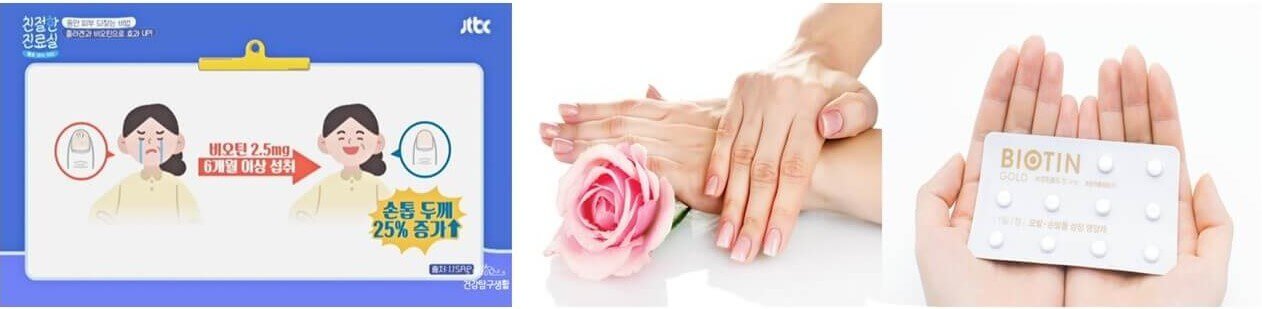 비오틴 효능_피부 질환 개선