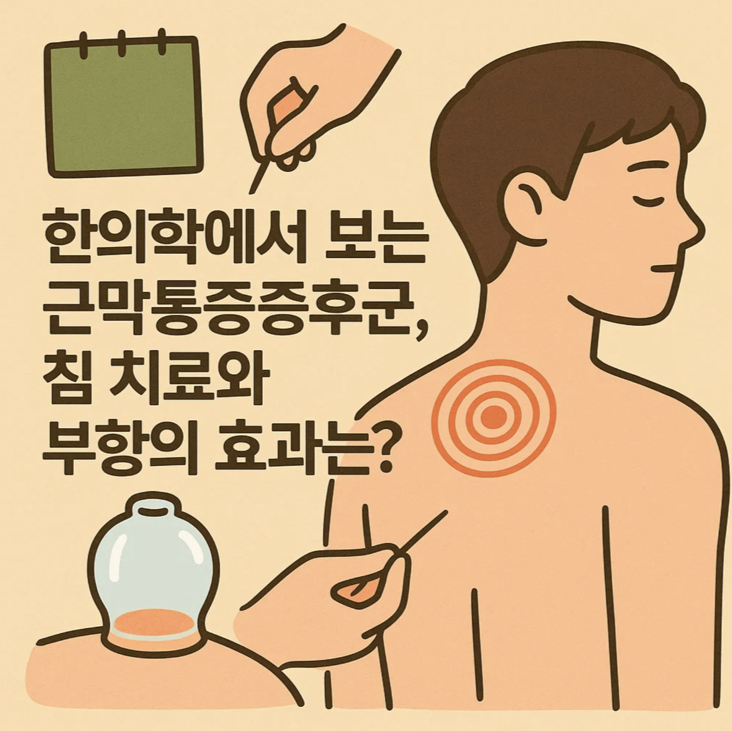 한의학에서 보는 근막통증증후군, 침 치료와 부항의 효과는?