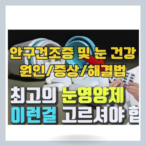 안구건조증 증상 원인 해결 방법 - 눈 영양제 추천 ❘ 눈 침침한 증상도 해결 썸네일