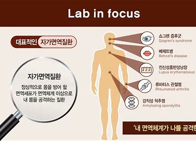 자가면역질환의 이해와 생활습관을 통한 관리법