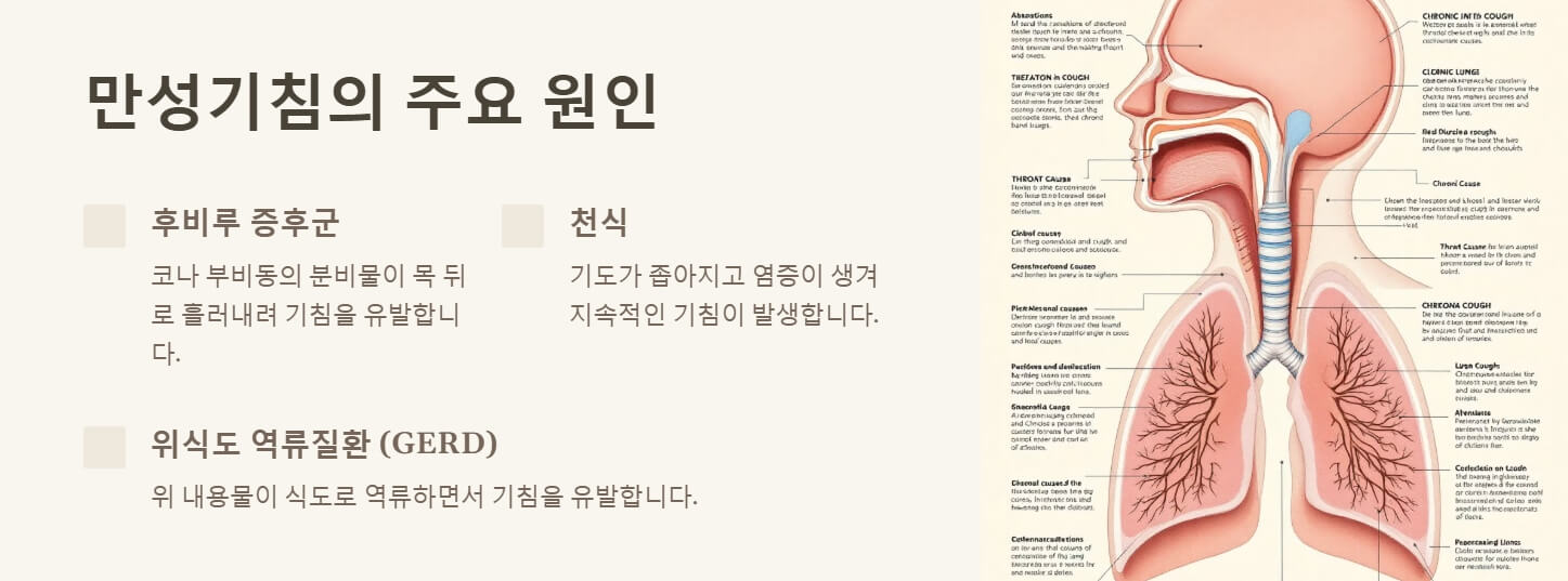 만성기침 원인 치료
