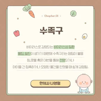 수족구 어른 전염에 대한 원인과 예방법 정리_14