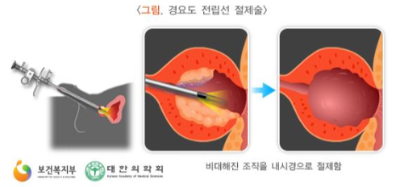 치료방법