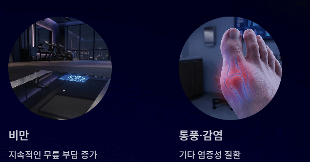 무릎에 물이 차는 증상