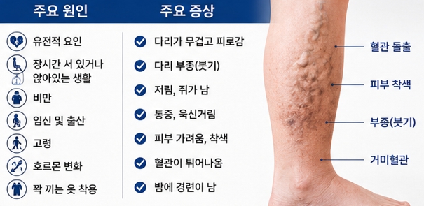 림프부종