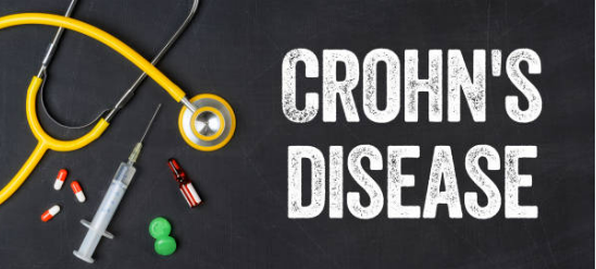 크론병