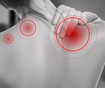 독감-증상-종류-건강