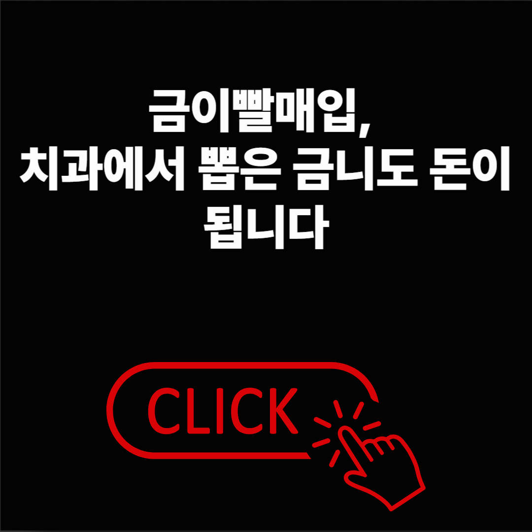 금이빨매입, 치과에서 뽑은 금니도 돈이 됩니다