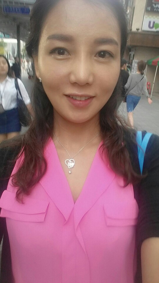 상안검 수술 후기
