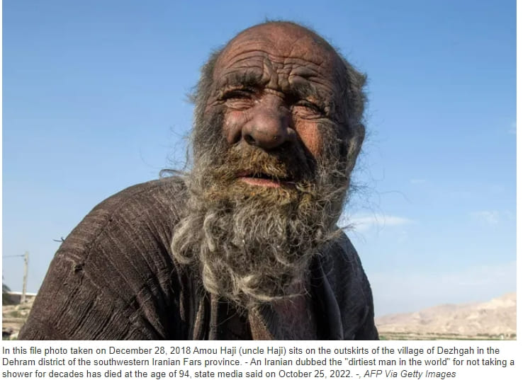 60년 이상 목욕 안한 ''세계에서 가장 더러운 사람' 첫 목욕 후 사망 VIDEO: World's Dirtiest Man Dies Shortly After First Bath