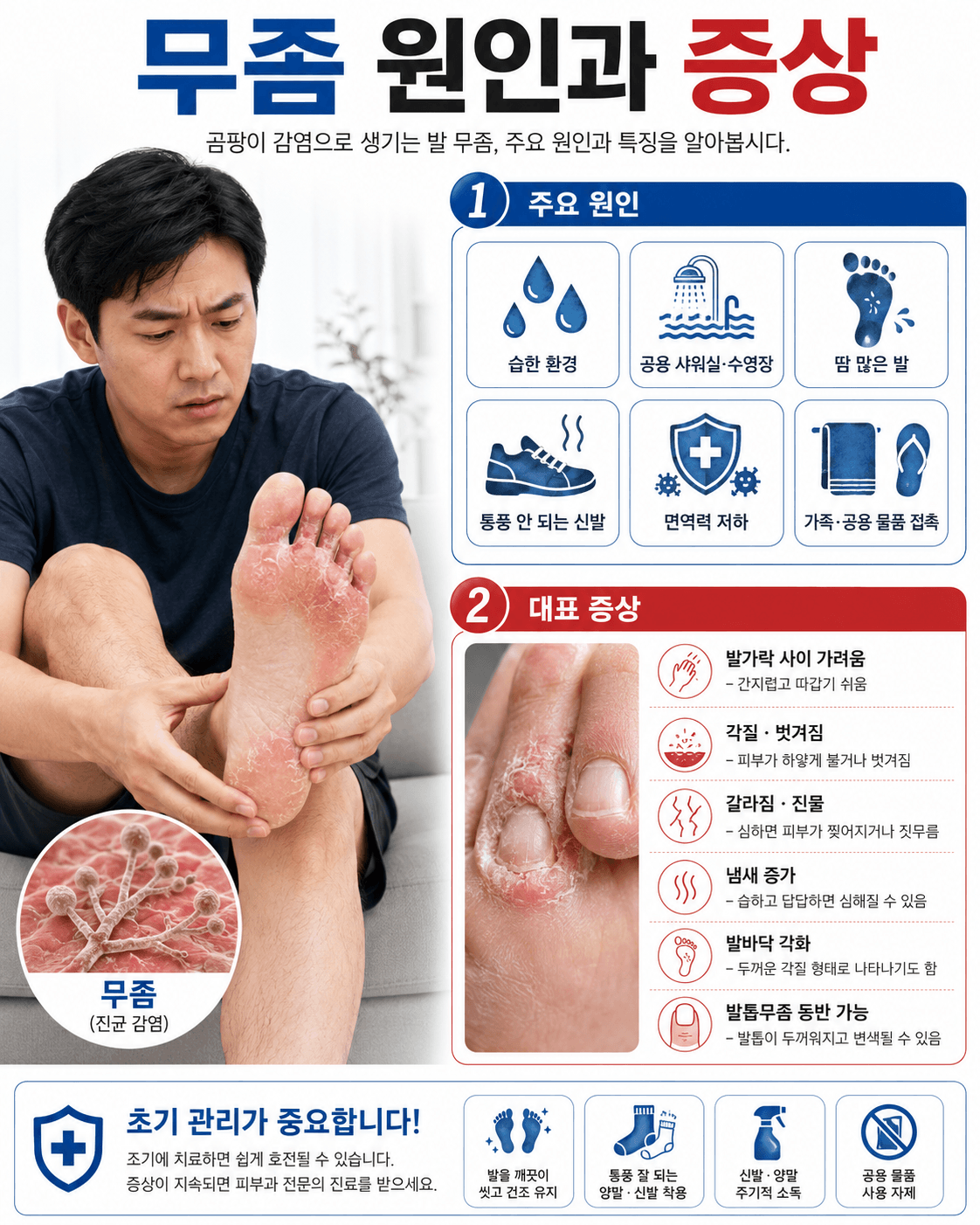 무좀 원인과 증상