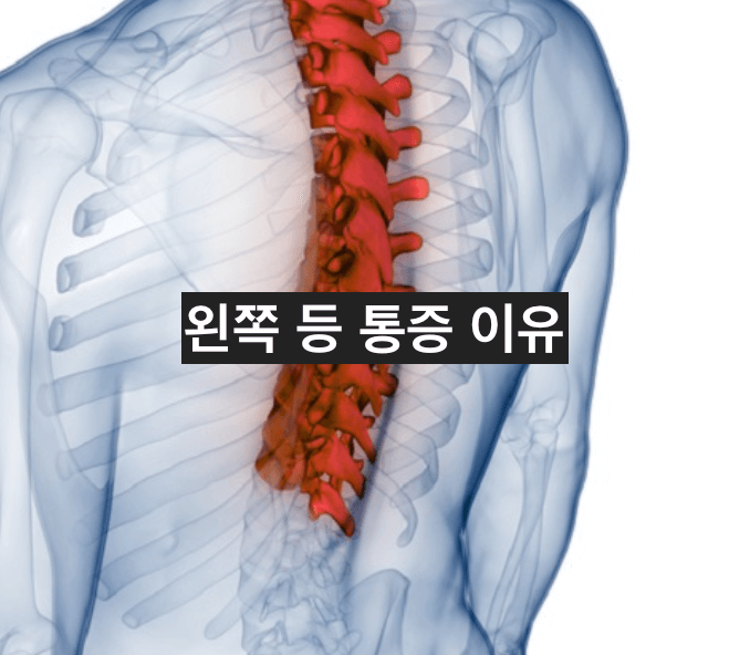 등 통증 사진