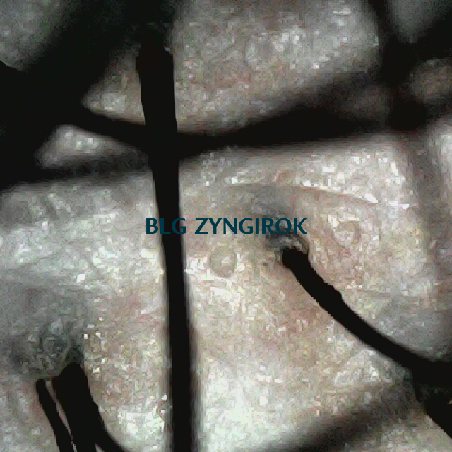 피나모아 복용 18주차 - 뒷머리 두피 모습이다.