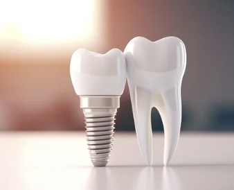 임플란트 모형 사진