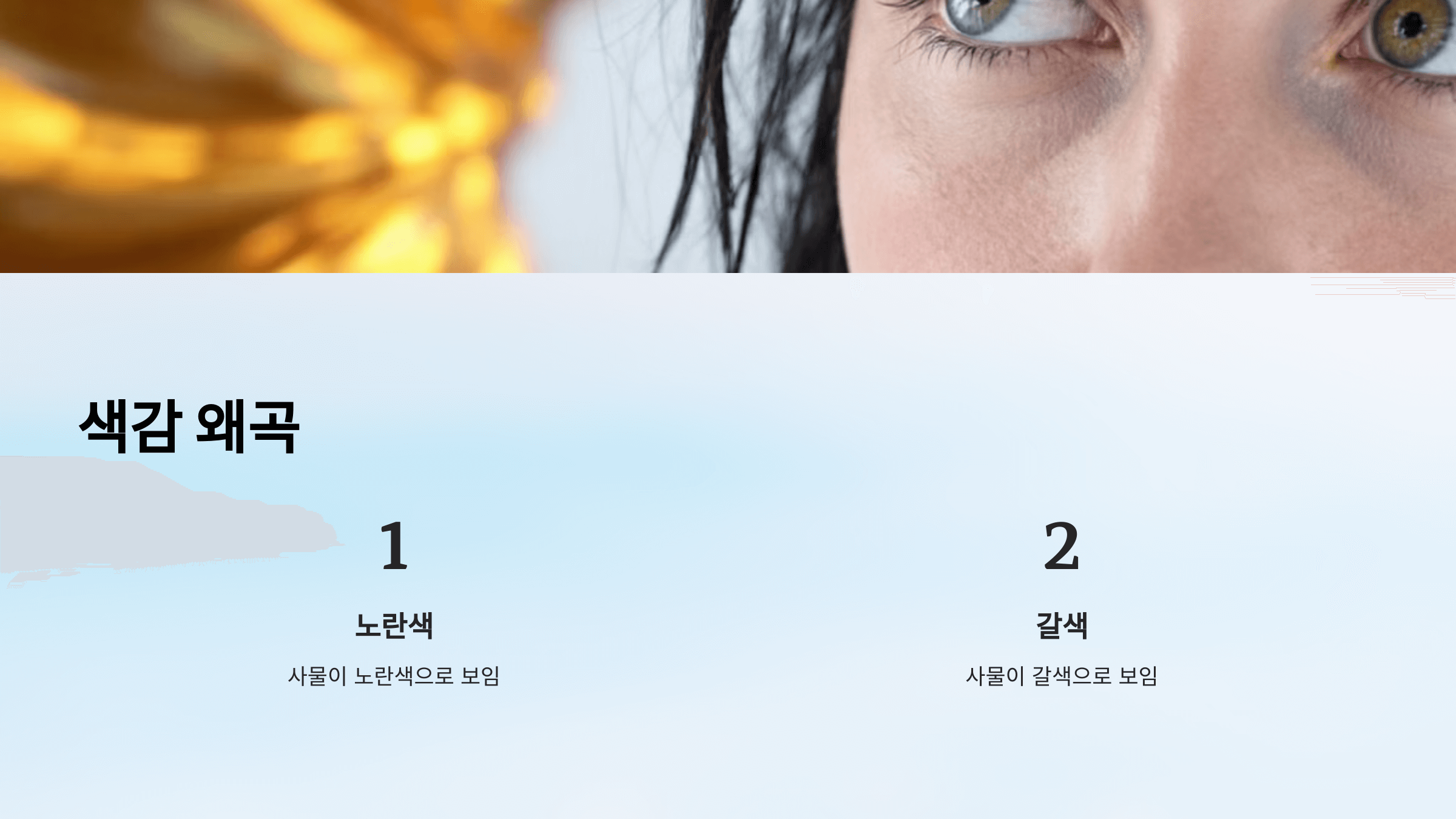 백내장과 관련된 사진입니다.